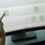 EKG monitooringu tulemuse visuaali näide